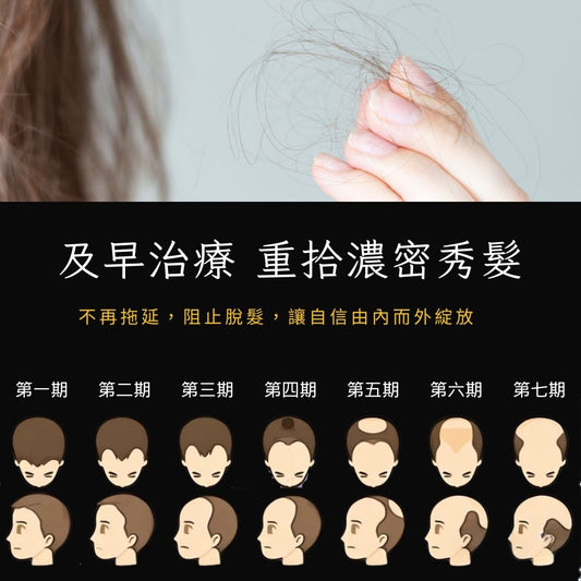 雄性禿頭的7個階段 —— 及早治療,不再拖延!