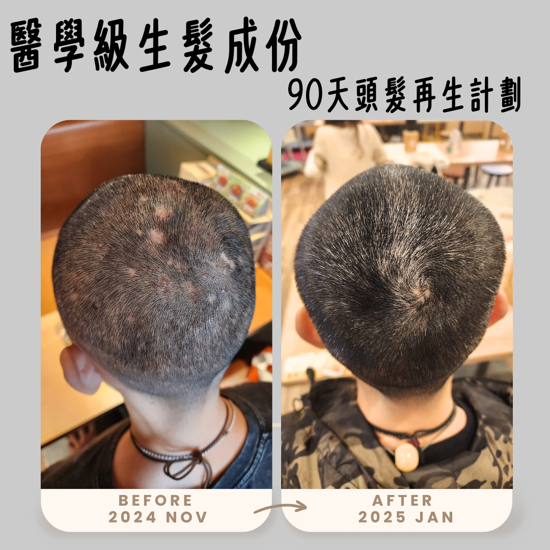 生髮套裝